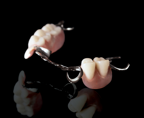 Cast Partial Dentoires
