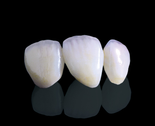 E.MAX image 2