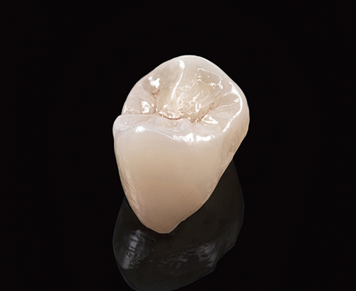 P.F.Z (Porcelain Fused to Zirconia) image 2
